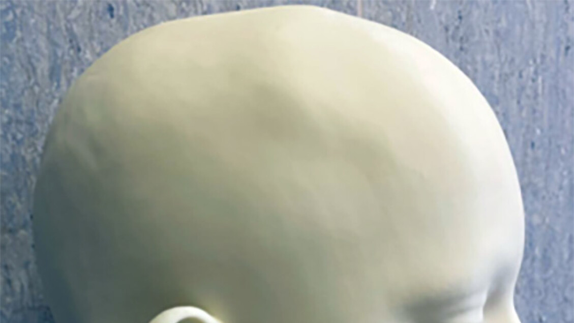 3D reconstruction of nose and lip for child bitten by animal - Science & Tecnology - Ansa.it