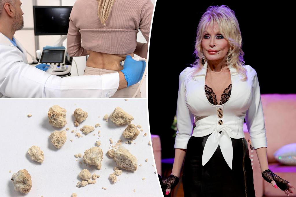 6 signs of kidney stones as Dolly Parton cancels event because one...