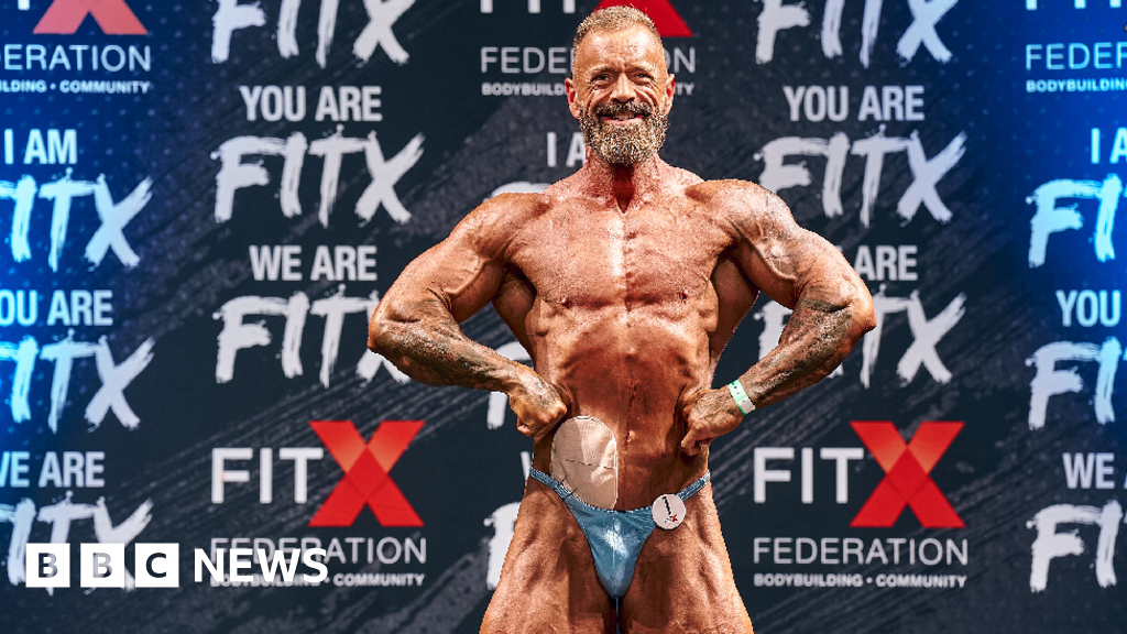 Bridgend bodybuilder returns to stage with stoma bag after bowel cancer