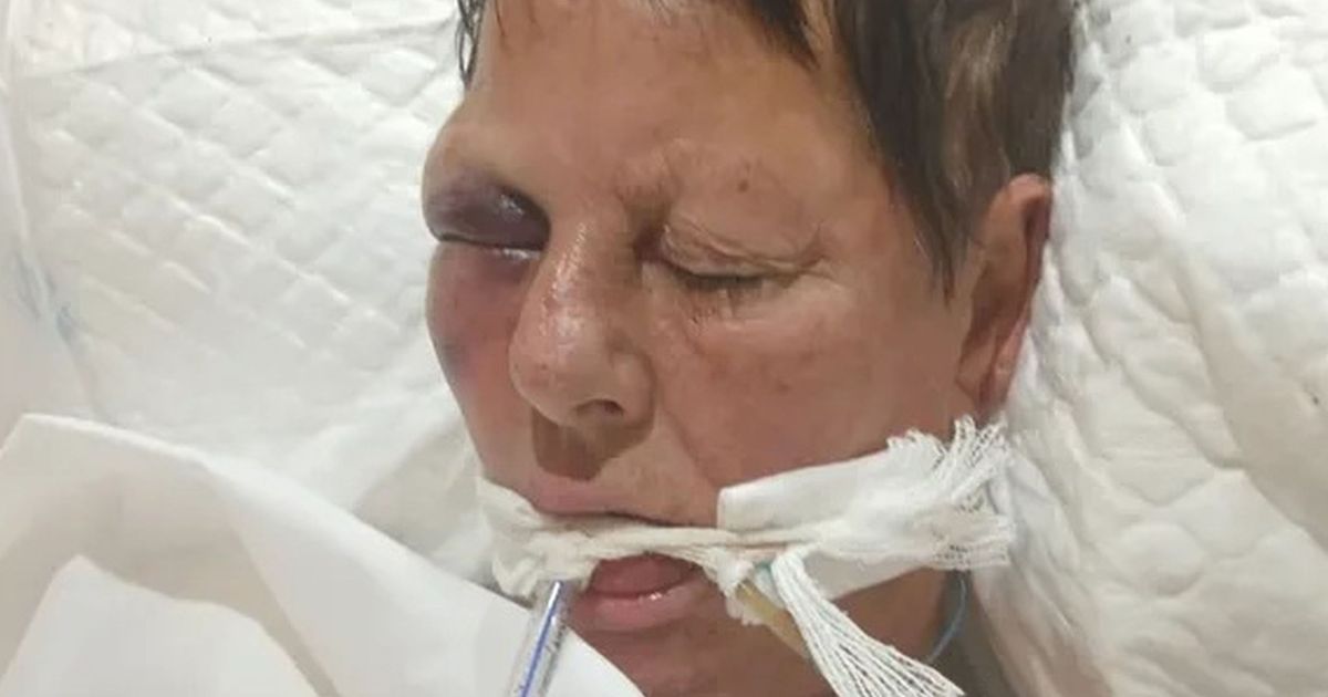 Brit tourist fighting for life in in holiday hotspot from 'heat stroke collapse'