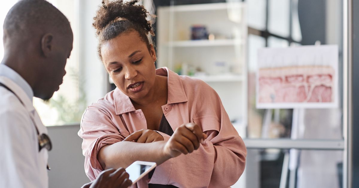 'Call 111 urgently' if you spot this skin symptom amid UKHSA alert - The Mirror