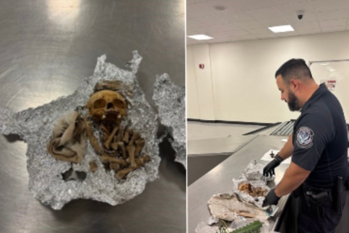 Human skull and bones discovered in passenger's luggage at Florida airport
