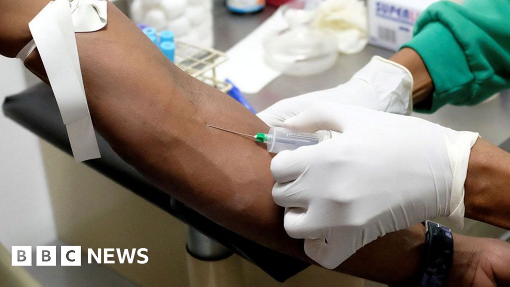 Hundreds of Blackpool healthcare workers set to strike over pay