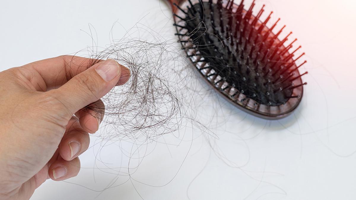 Indo-US research collaboration identifies cholesterol's role in irreversible hair loss