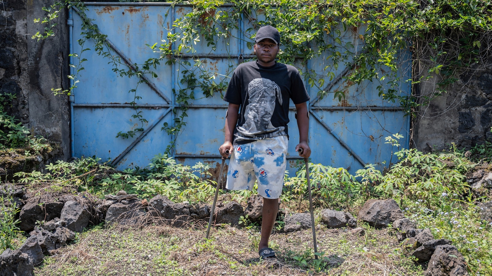 On the front line of Congo's conflict, a trauma center tells a story of horror and survival