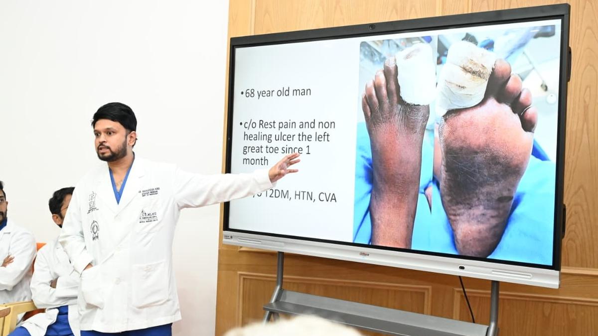 Rare surgery performed at KLES hospital