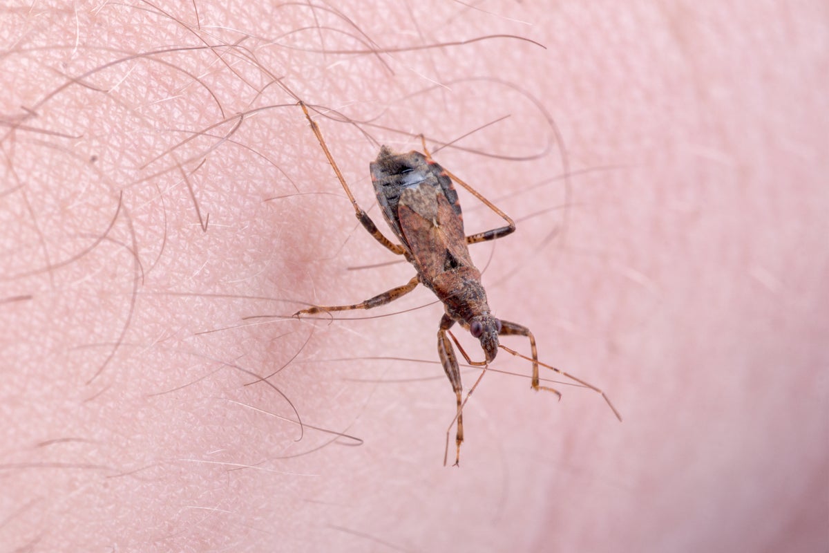The symptoms of 'kissing bug' disease to be on the look out for