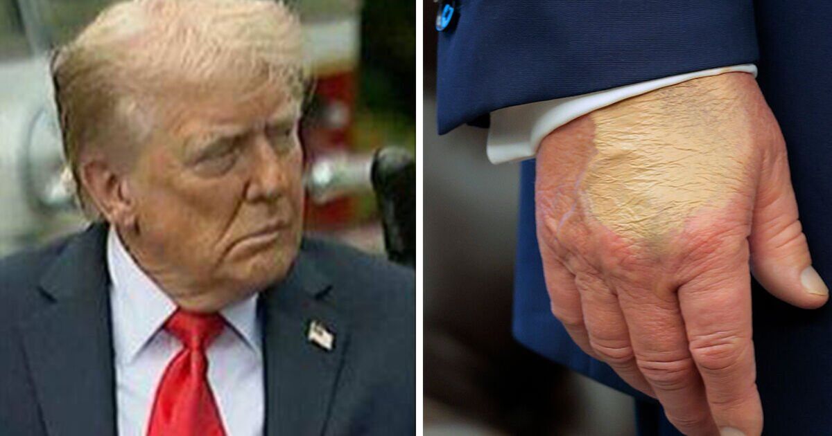 Trump's health must be tested like every ageing world leader, expert says