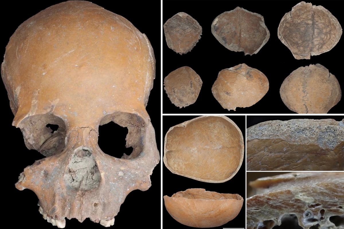 5,000-year-old tools made of human skulls unearthed, including masks...