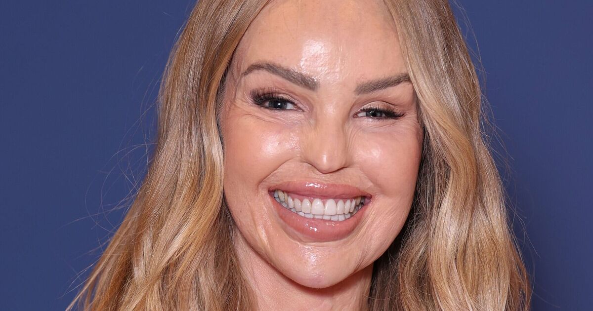 Katie Piper - 'Kindness Is the Real Superpower'