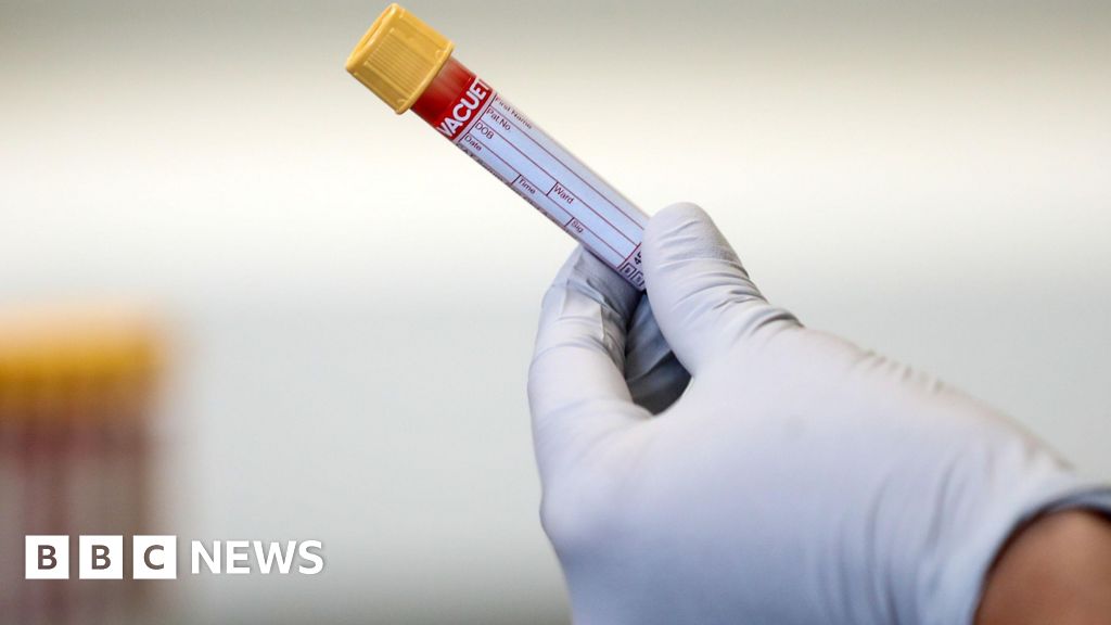 Lancashire MP urges more men to get prostate cancer blood test