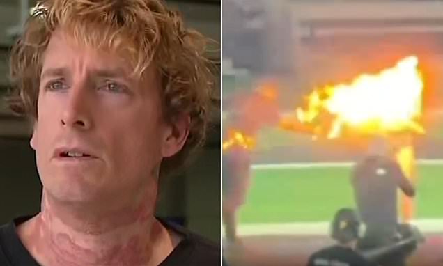 Prankster left hospitalised after stunt goes horribly wrong