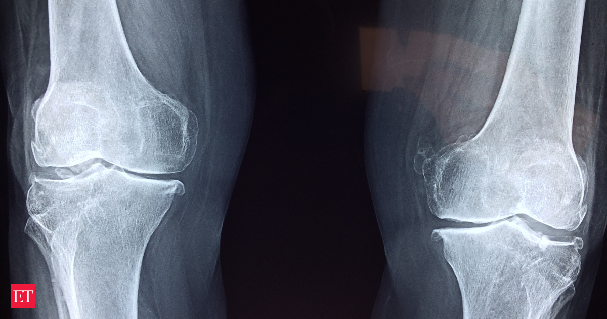Want stronger bones? This fruit packs more Calcium than any other, says expert