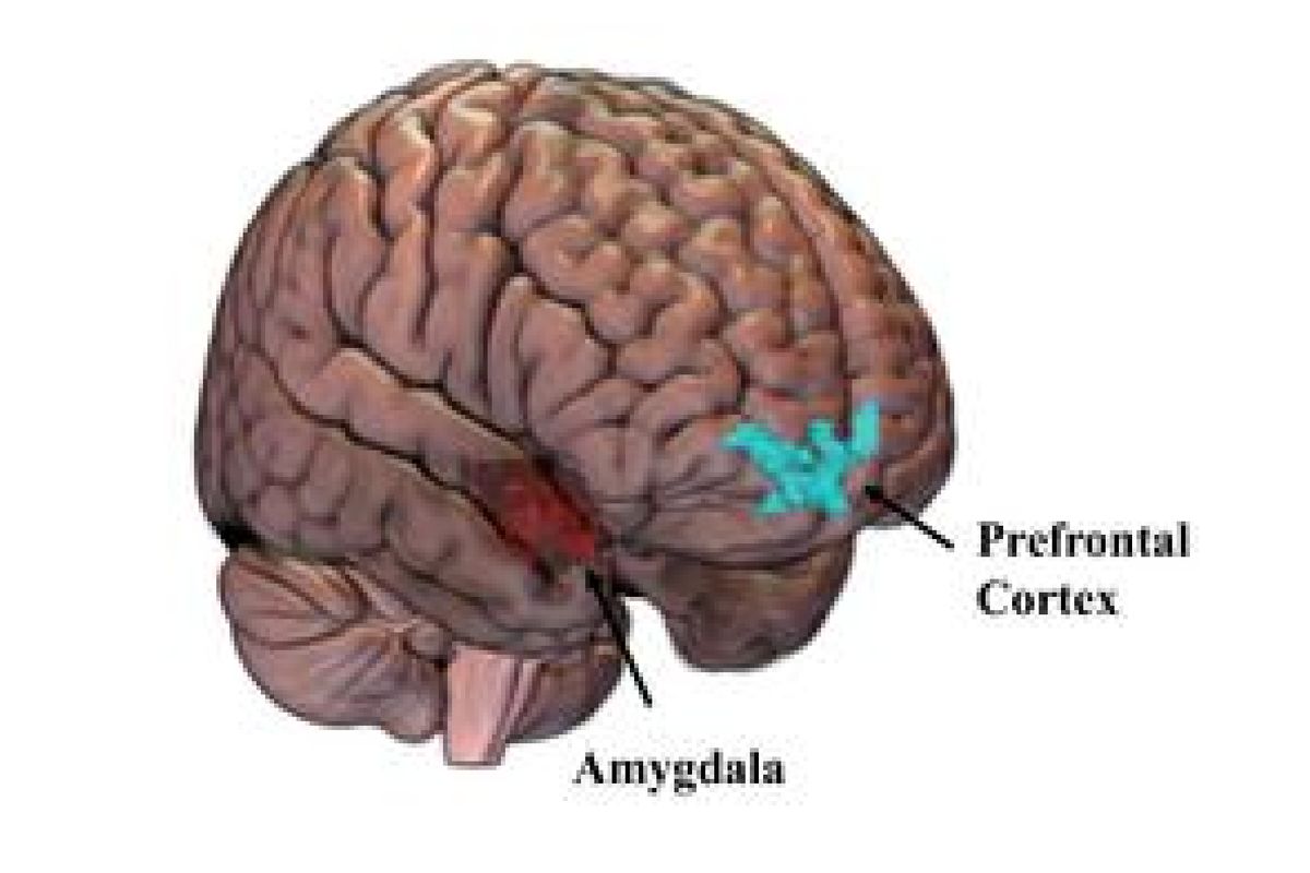 Study finds women's brains may change after sexual assault