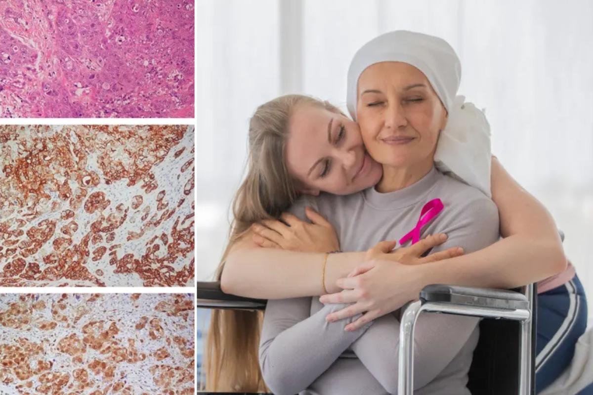 'Smart bomb' drug actually works better than chemo for...