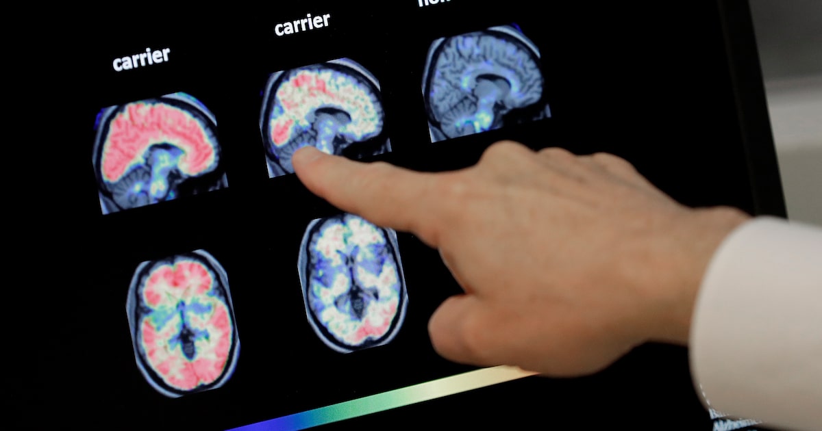 New Texas initiative could shape the future of dementia research, scientists say