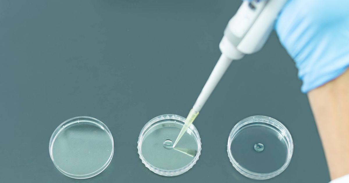 Single drop of toxic liquid led to teacher's agonising death 10 months later - The Mirror