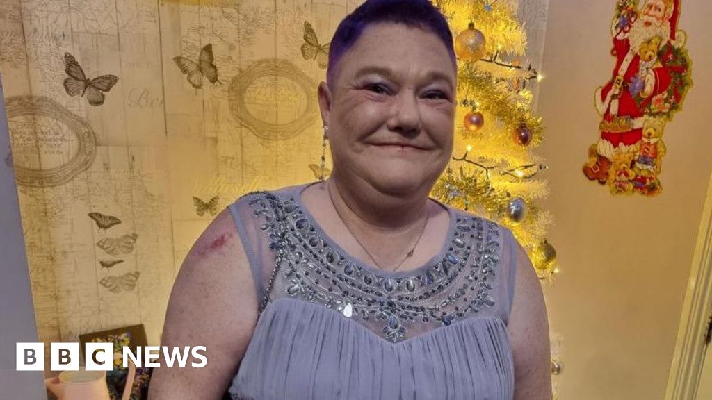 Cancer diagnoses "too late" for people with learning disabilities