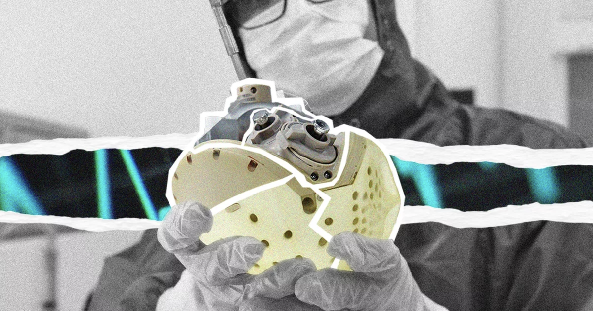 "The Carmat Artificial Heart: How a Medical Miracle Became a Financial Tragedy"