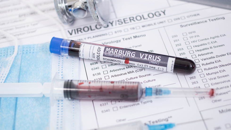 Ethiopia confirms first deadly Marburg virus outbreak  --  RT Africa