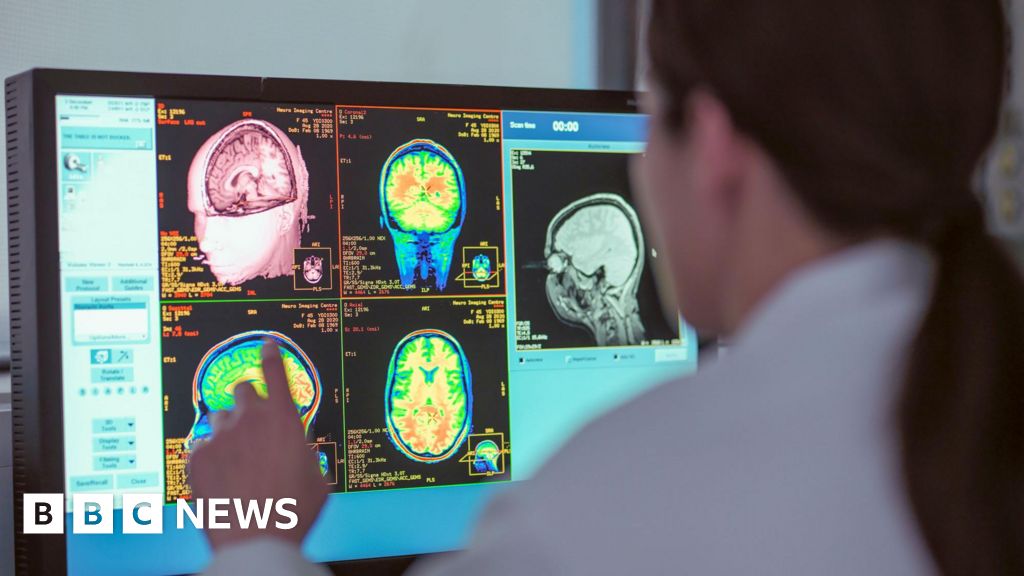 Four pivotal ages in your brain's development revealed in new scientific study