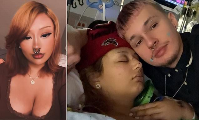 Girl, 20, has leg amputated after car mowed her down on bike ride