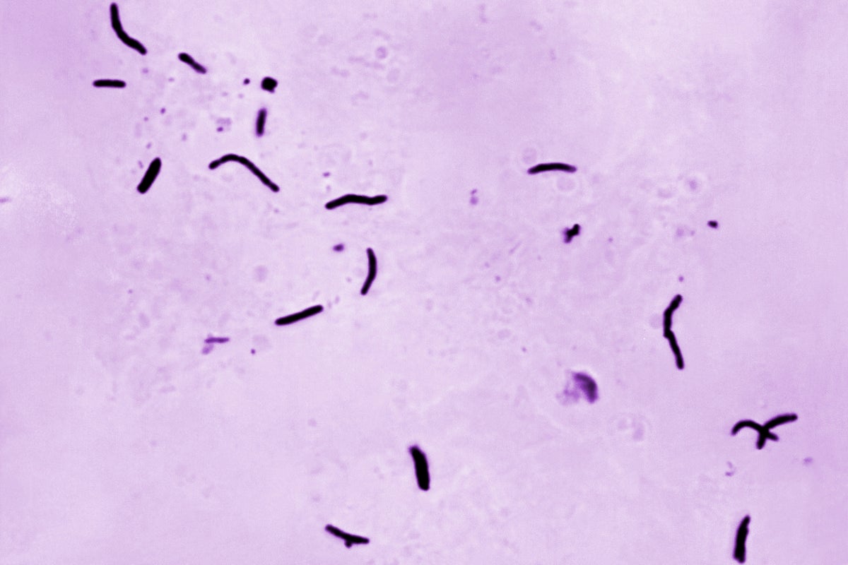 Global tuberculosis diagnoses rise to a record, but deaths fall, WHO reports