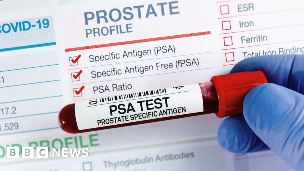 Gloucester Rugby fans to get prostate cancer advice at home match