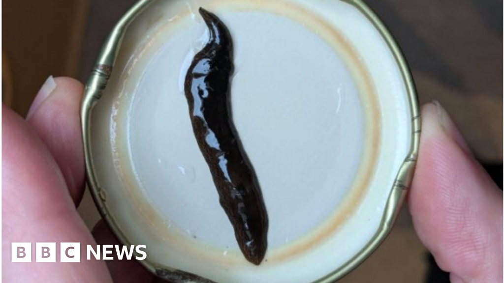 People asked to report invasive Obama flatworm found in Alderney