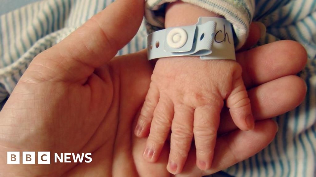Pregnant mothers waiting 62 hours to be induced at Forth Valley