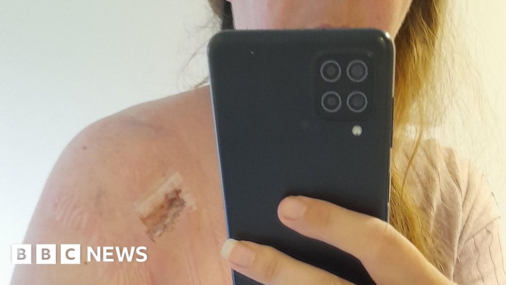 Scarborough woman left in pain after vaccine receives payment
