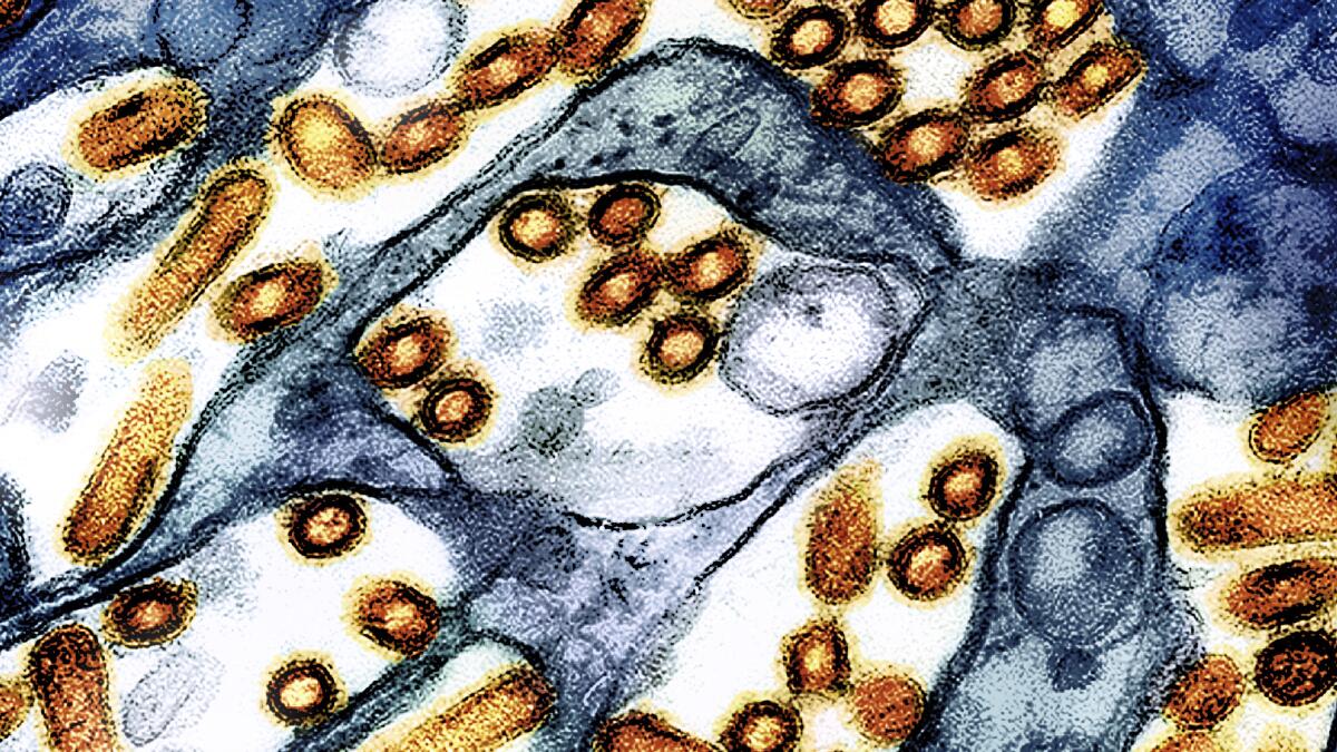 Washington state resident dies of new H5N5 form of bird flu