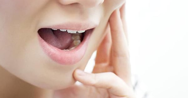 Study Finds Wisdom Tooth Extraction Risk Jumps 4.8 Times for Those Over 40