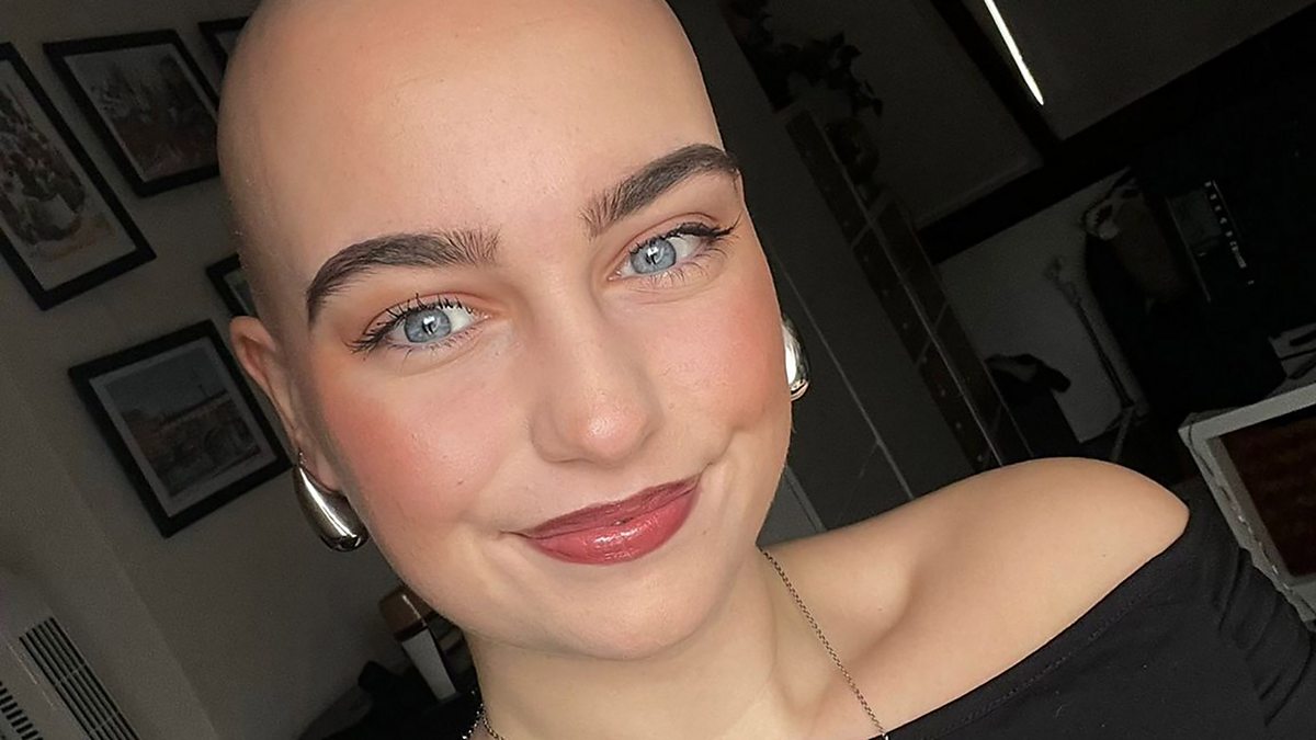 BBC World Service - The Documentary Podcast, Women share stories of losing their hair