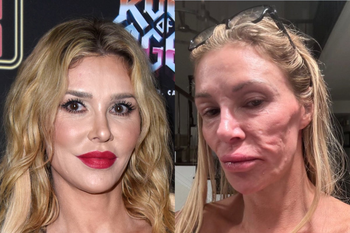 Real Housewives alum says she's finally received diagnosis for facial disfigurement