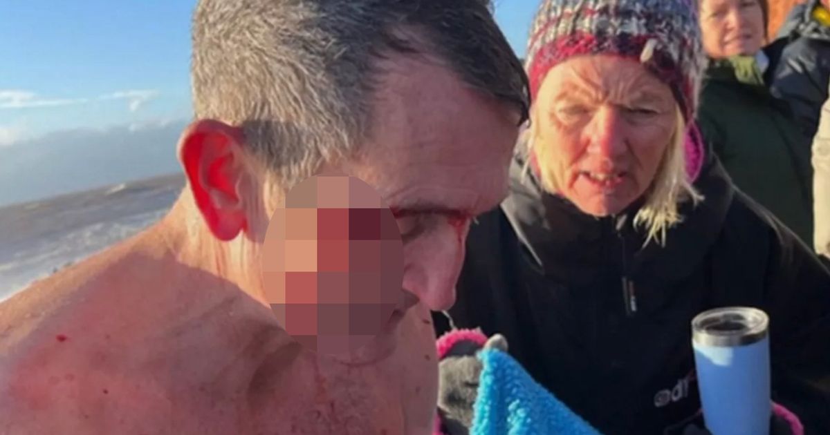 Budleigh Salterton Christmas Day swimmer ALIVE after being saved by brave bystanders - The Mirror