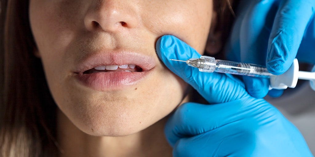 Cosmetic fillers can cause deadly complication, experts warn  --  but new tech exposes it