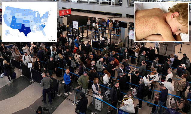 Doctors warn where holiday travel puts you most at risk for measles