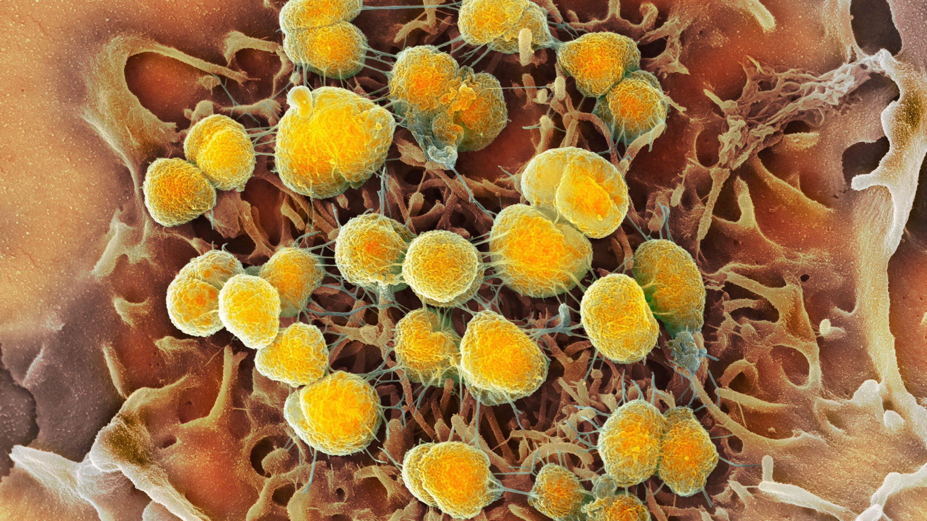 F.D.A. Approves Two New Drugs to Treat Gonorrhea