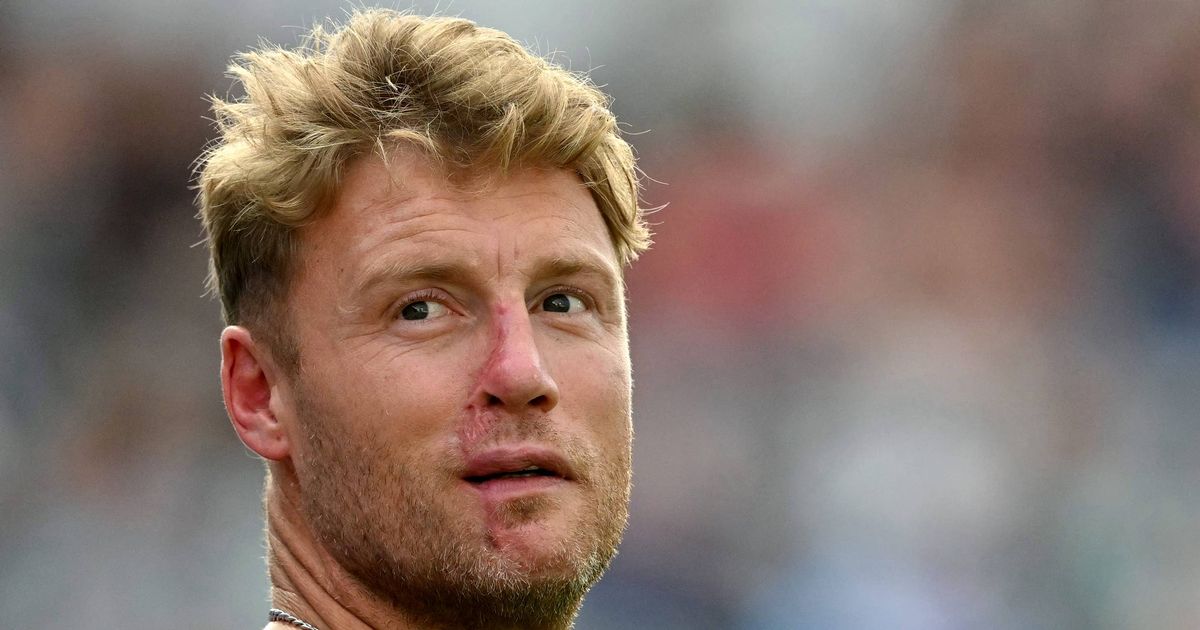 Freddie Flintoff's worrying comment about BBC accident that left him with scarred face - The Mirror