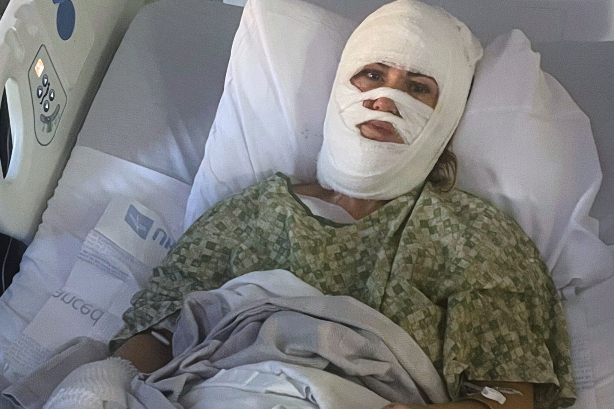 A Georgia woman suffers severe burns in a chemical attack at a Savannah park