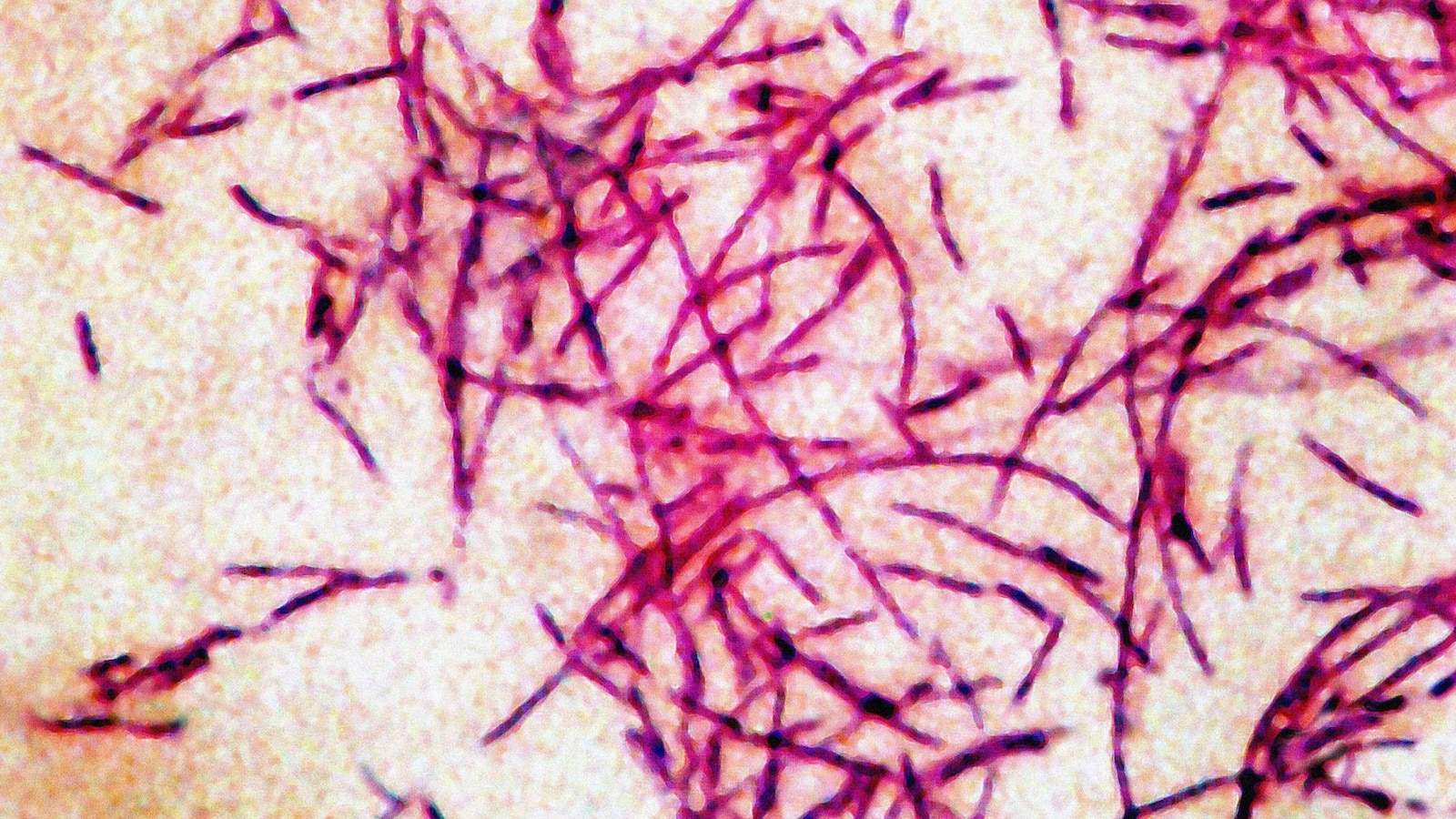 14 cases of Legionnaires' disease reported in Florida, may be linked to gym