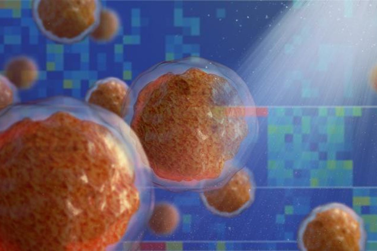 Scientists say this silent bone change could be early sign of leukaemia