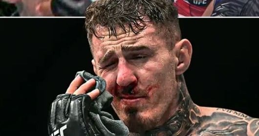 UFC Champion Aspinall Confirms Eye Surgery After Gane's Poke