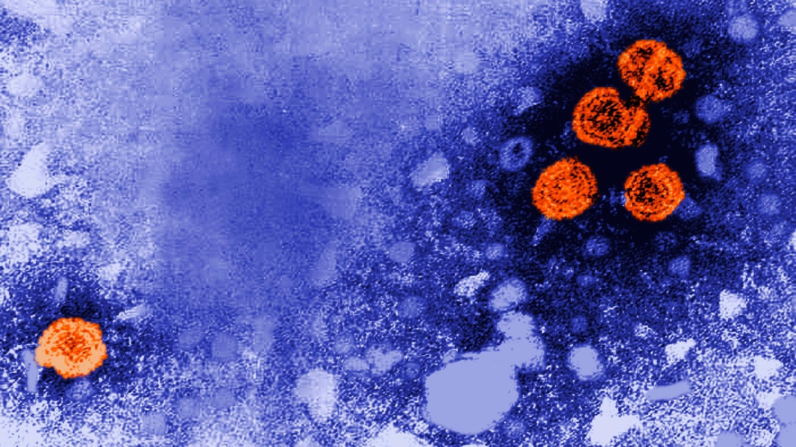 US awards no-bid contract to Denmark scientists studying hepatitis B vaccine in African babies