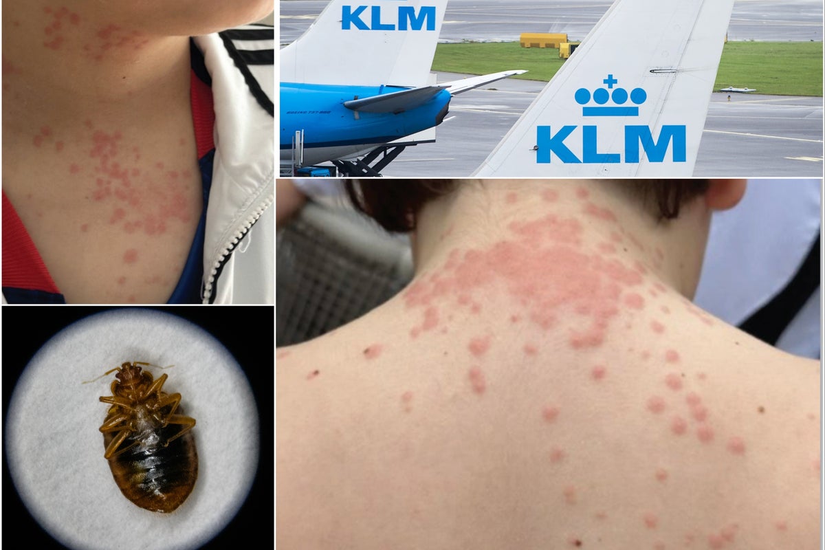 Family ambushed by bed bugs aboard transatlantic flight sues over ruined trip