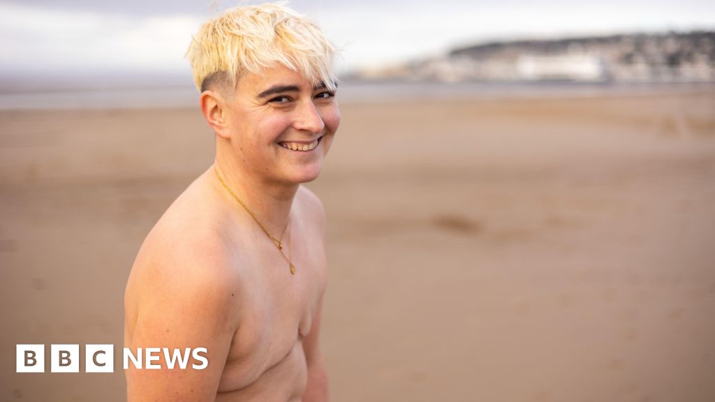Weston woman with double mastectomy runs topless for charity