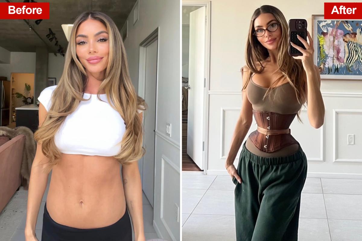 Exclusive | Young women are spending over $10K on a drastic new slimming surgery...