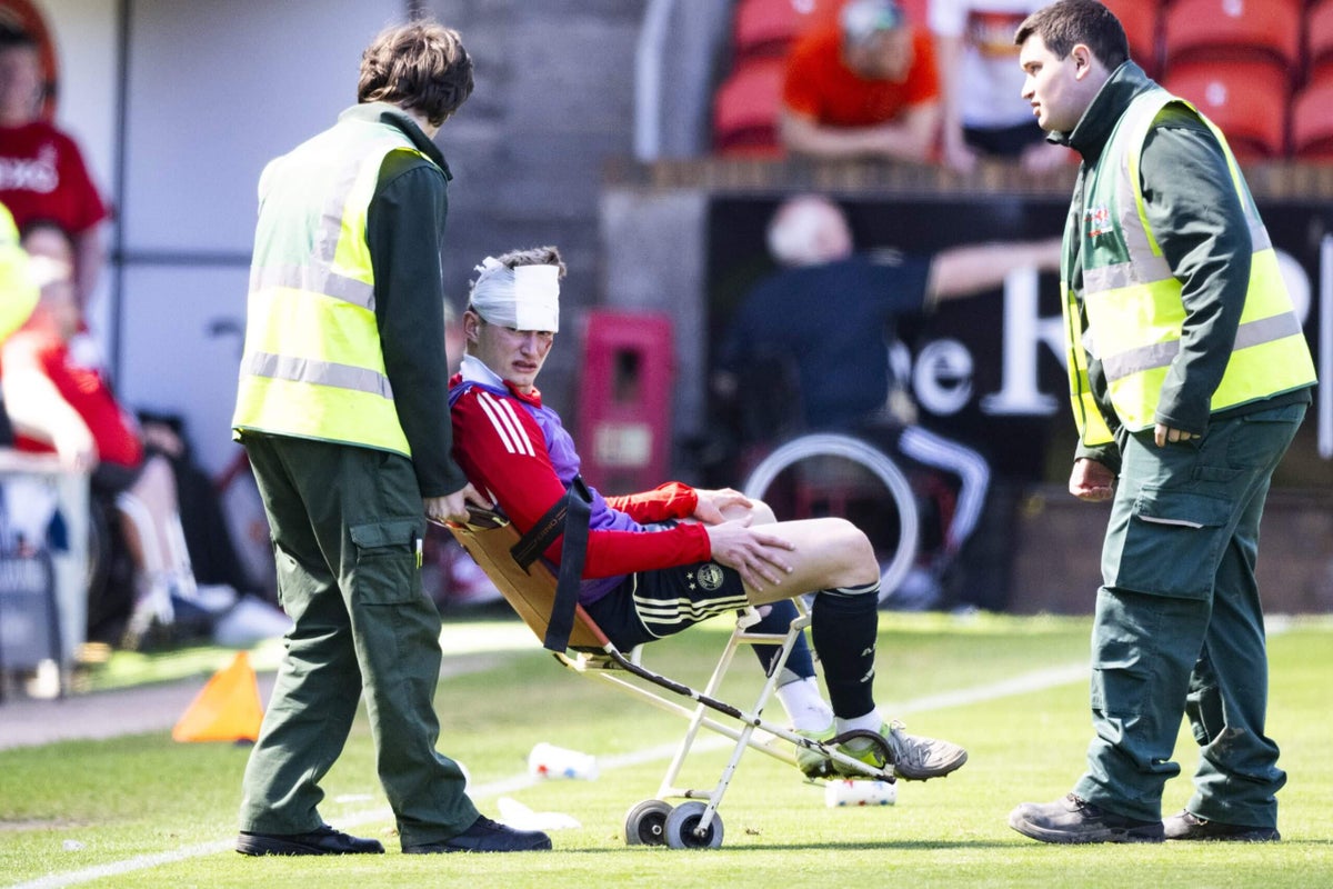 Aberdeen fan jailed for 18 months after 'disgraceful conduct' that left footballer disfigured