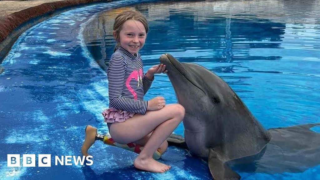 Bullied Cheshire girl's leg plea 'heartbreaking' for dad